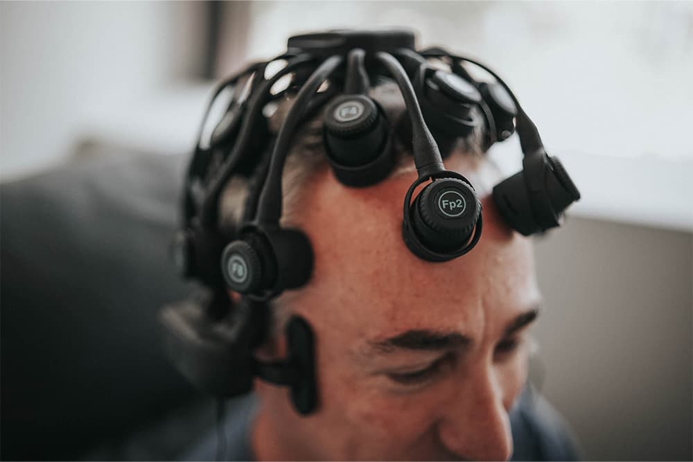 tms for early stage dementia