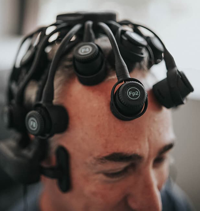 tms therapy for post concussion syndrome